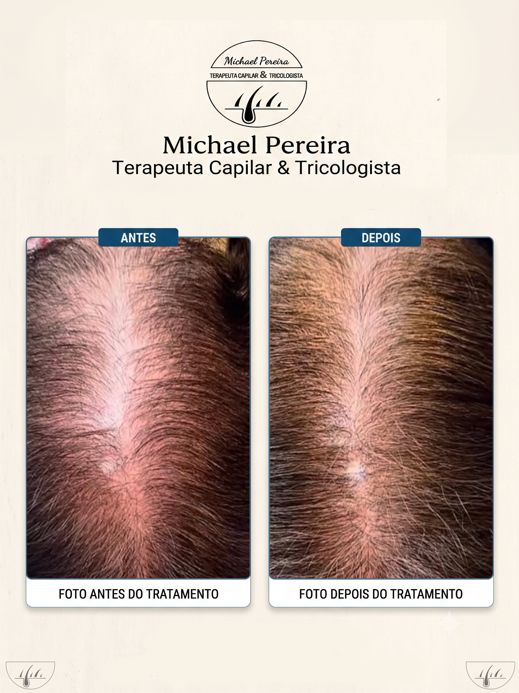 antes e depois 1.1