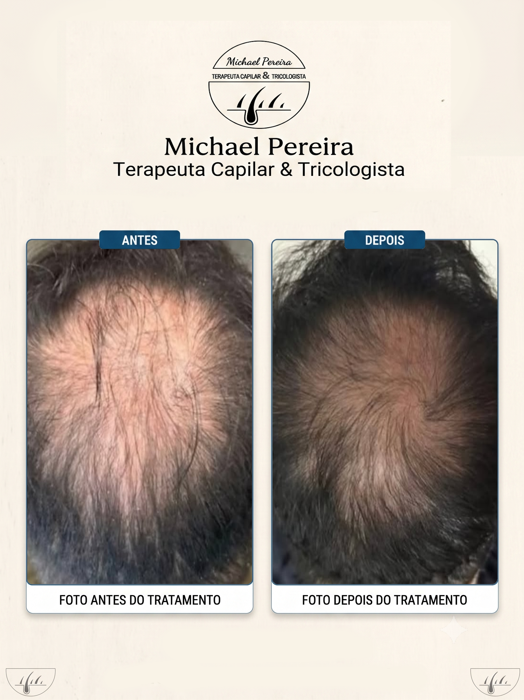 antes e depois 2.2