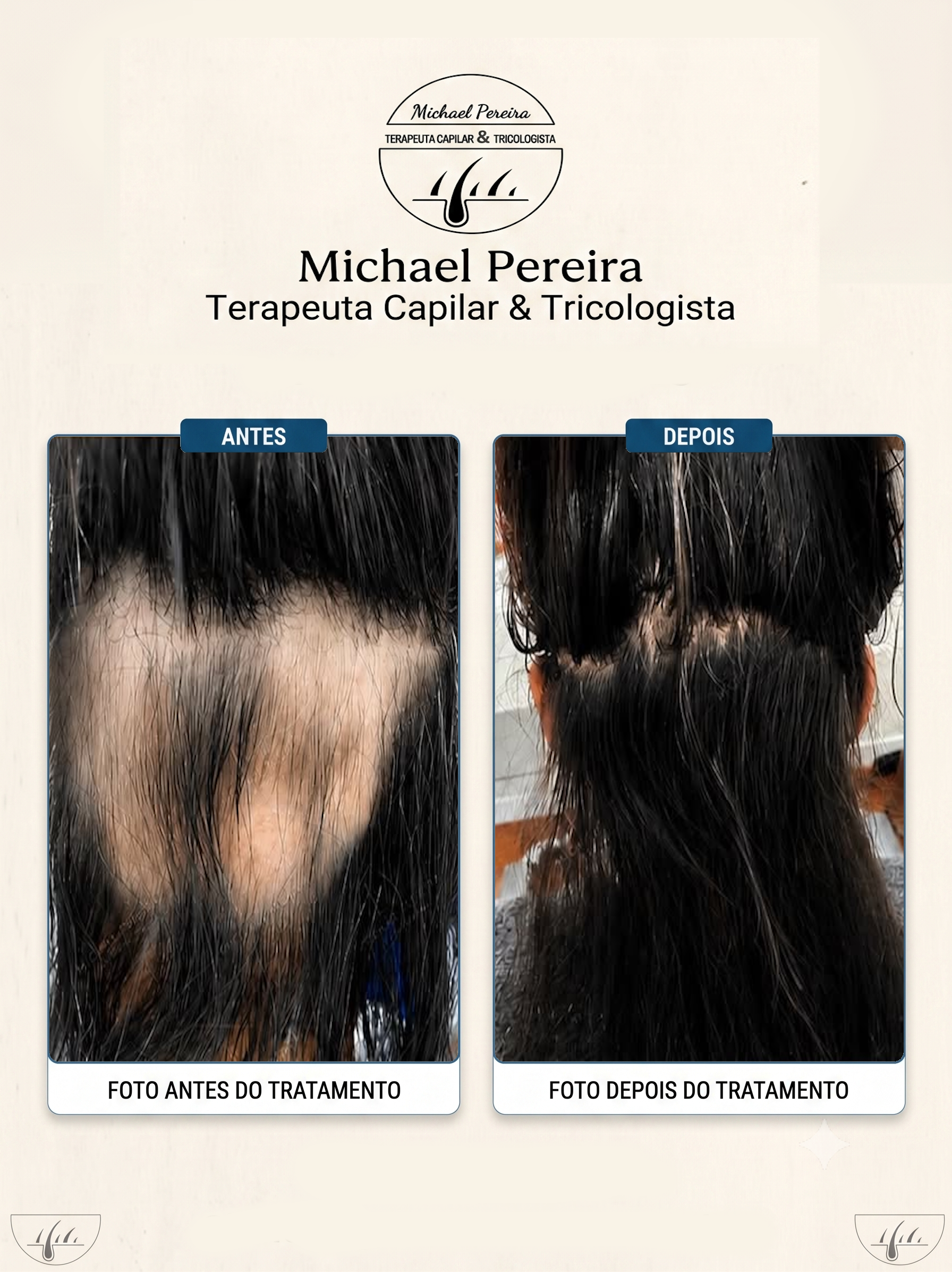 antes e depois 3.3