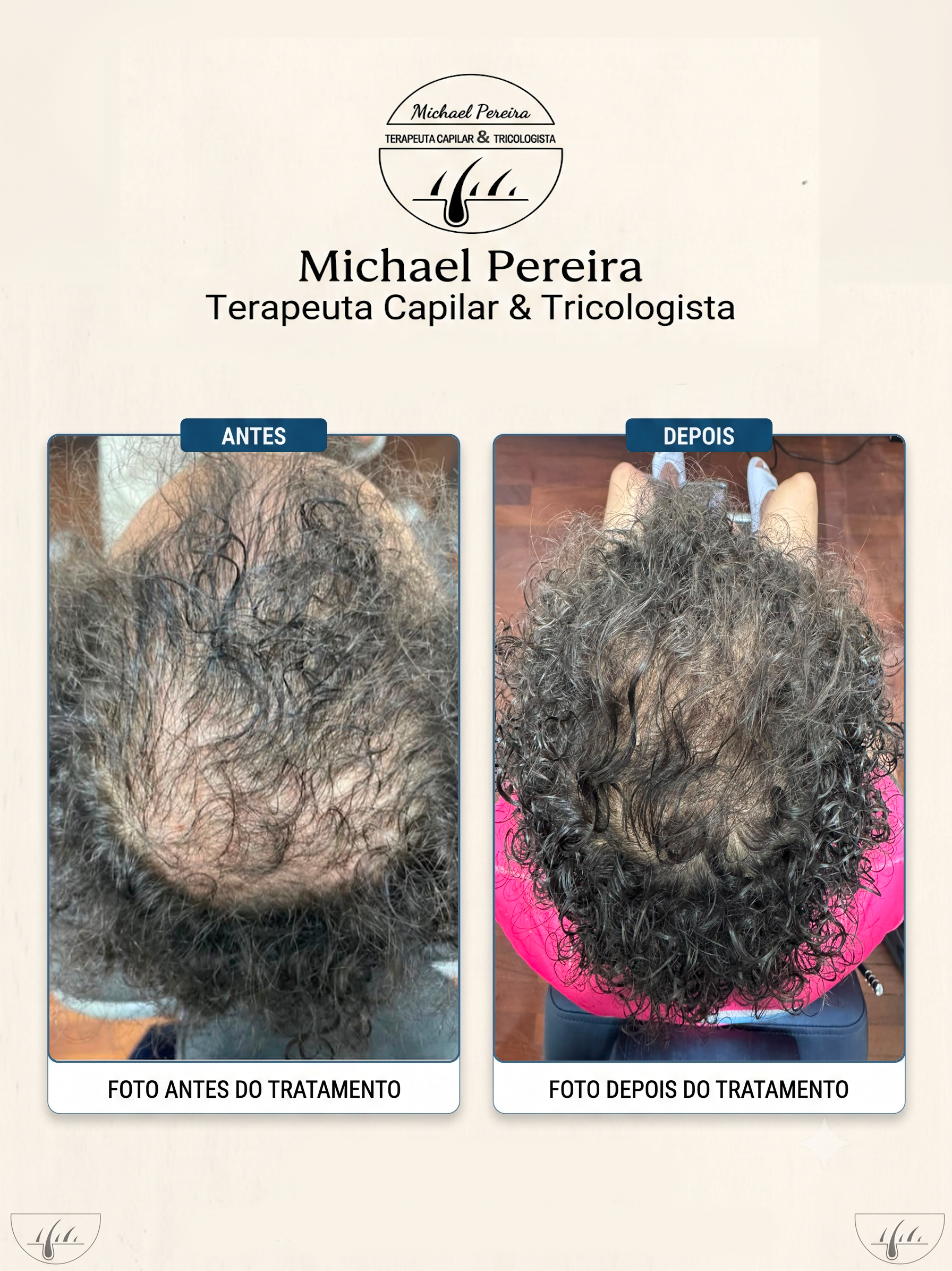 antes e depois 4.4
