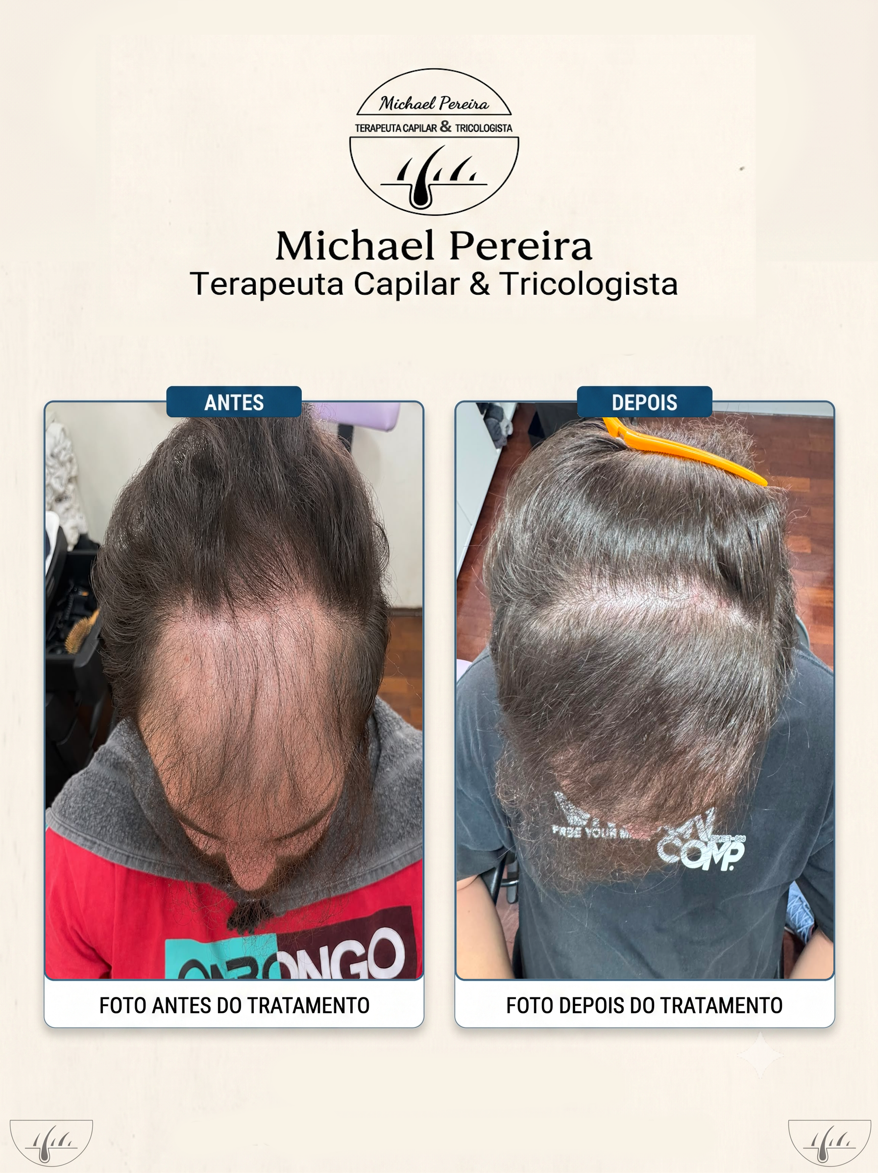 antes e depois 5.5